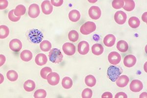 Malaria - Diagnose - Infektion im Blut
